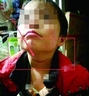 江苏6岁男孩遭父亲毒打勒脖险丧命
