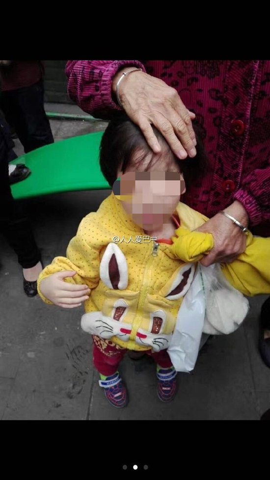 女童的头部有伤痕。 来源：@人人爱巴中