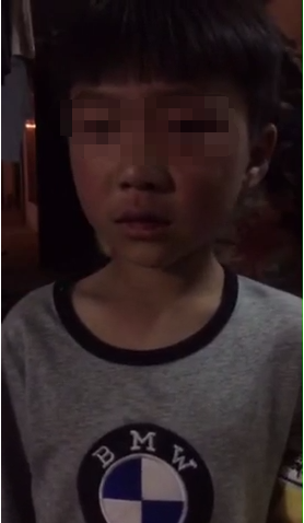 5岁男童被亲戚殴打全身伤痕累累 只因弄丢钥匙