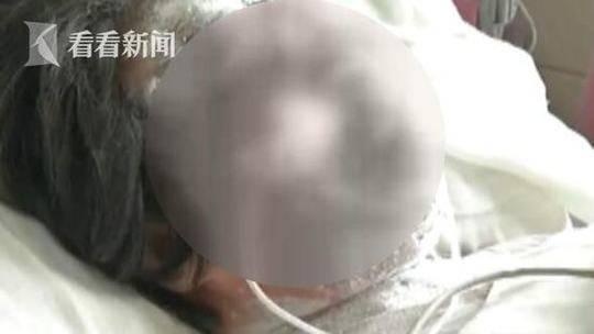 儿子要钱遭拒后向母亲泼硫酸致其毁容双目失明