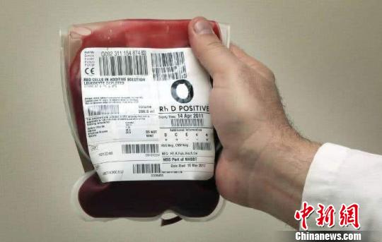 “熊猫血”产妇诞双胞胎困难丈夫全城寻找血源